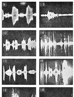 Respiratory Sounds Used with Spectrum Analysis